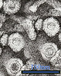 Электрон микроскопын гепатит В вирусийн микрограф