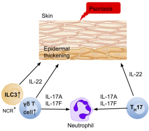 A diagram of the skin epidermis, and the ILC3s, and other effector cells (T cells, neutrophils) present in the environment, and their effector cytokines involved in causing psoriasis.