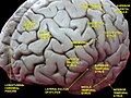 Cerebrum. Lateral face. Deep dissection.