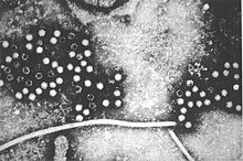 TEM micrograph of "Orthohepevirus A" virions