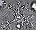 Dendritická buňka