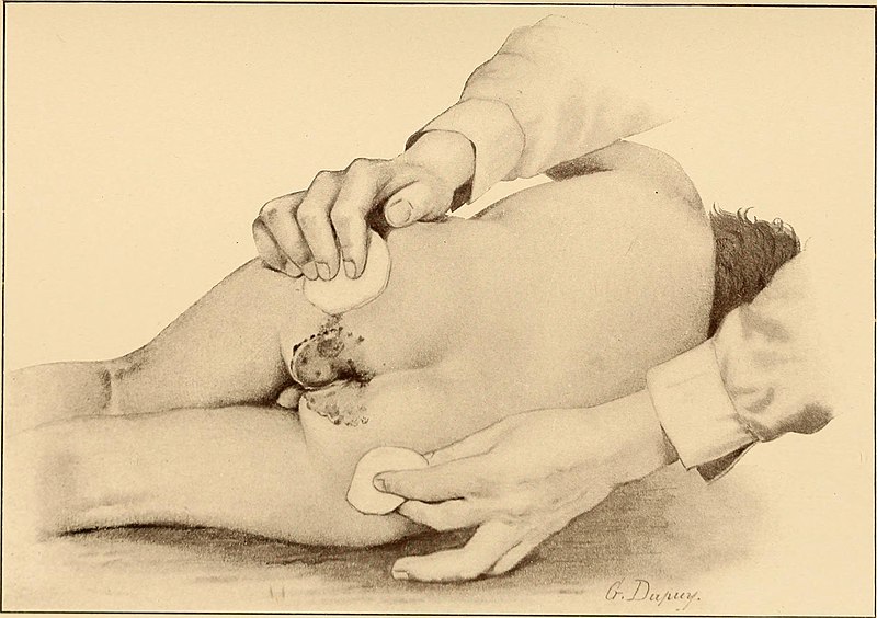 File:The diseases of infancy and childhood (1910) (14577332930).jpg