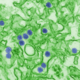Transmission Electron Microscopic image of Zika virus