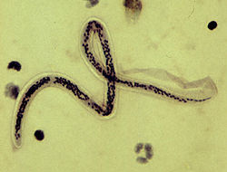 Мікрофілярія Wuchereria bancrofti у хворого з Гаїті (мазок крові із забарвленням гематоксиліном)