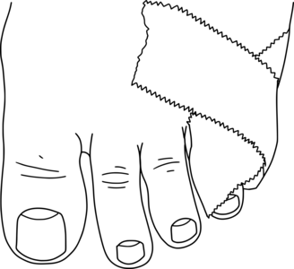 fourth and fifth toes wrapped in a loop of tape which crosses over the bases of the toes, with the ends overlapping onto the body of the foot.