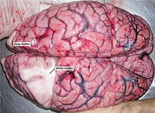 Dissection d'un cerveau démarquant la substance blanche de la matière grise.
