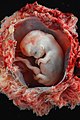 Ludzki zarodek w 10 tygodniu ciąży (koniec okresu zarodkowego).