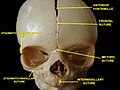 Human baby skull. Anterior view.