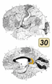 ブロードマンの脳地図における30野。