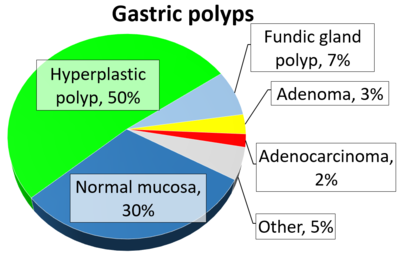 Relative incidences of gastric polyps.