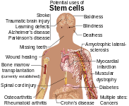 Áreas do corpo humano onde a aplicação da terapia com células-tronco[5] é promissora.