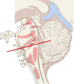Brain stem sagittal section