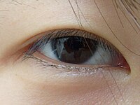 A dark brown iris is most common in East Asia, Southeast Asia, and South Asia