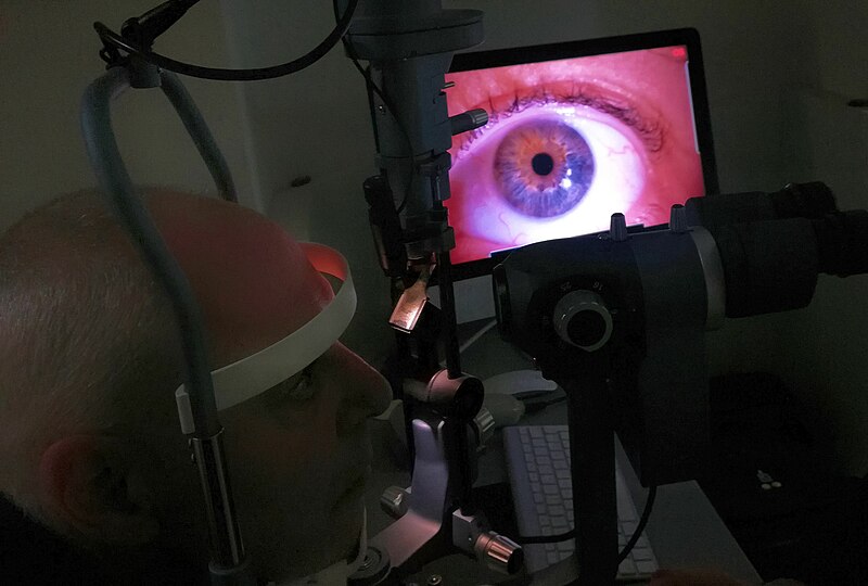 File:Analisi dell’apparato visivo attraverso strumento oftalmico in paziente umano dagli occhi chiari.jpg