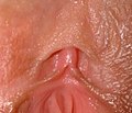 Frenilus klitorisa
