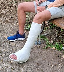 Orthopedic cast, plaster cast, cast with heel