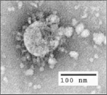 Electron micrograph of SARS-CoV.
