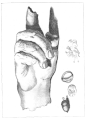 Drawing (1800) of a bronze hand found in 1771