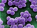 Thumbnail for Staphylococcus aureus