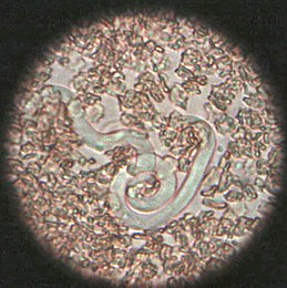 личинка Dirofilaria immitis, збільшено у 400 разів