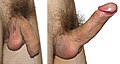Comparison of flaccid and erect uncircumsized human penis, shaved genitalia