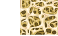 Spongy bone - Trabecular bone - Trabecular bone with microcracks