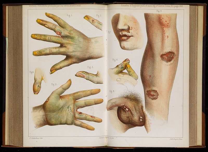 File:Accidents caused by the use of green arsenic, 1859 Wellcome L0075299.jpg