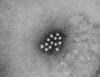Hepatitis A is one of waterborne diseases and its symptoms are only acute. Symptoms include fatigue, fever, etc.