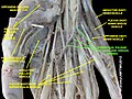 Superficial palmar arterial and venous arche