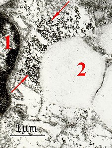 Electron microscope image of placental macrophage ferritin