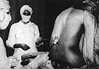 Nurses examine one of the Tuskegee syphilis study participants.