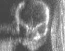 Sample image: Fetal face - third trimester pregnancy