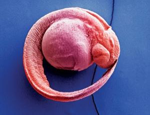 Zebrafish embryos like gravity (Image: Dr. Richard Kessel & Dr. Gene Shih/Visuals unlimited/SPL)