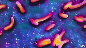 Vibrio Cholerae, bacterium that causes Cholera in humans