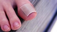 Herpes virus can cause blisters on fingers, toes
