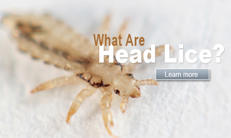 What Are Head Lice?