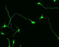 Beta III Tubulin in rat cortical neurones: ab18207
