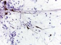 Tyrosine hydroxylase in rat primary cultured neurones: AB152