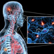 View Multiple Sclerosis Slideshow Pictures