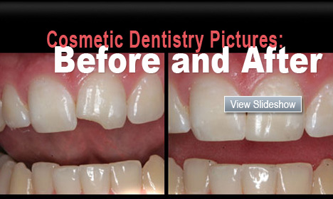 Cosmetic Dentistry Pictures: Before and After