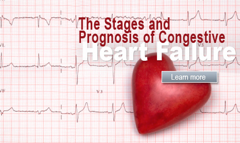 The Stages and Prognosis of Congestive Heart Failure