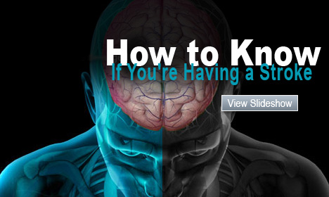 Stroke Pictures Slideshow: A Visual Guide to Understanding Stroke