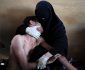 Das Pressebild des Jahres: Eine vollverschleierte Frau hält ihren Verwandten im Arm, der während Protesten gegen Präsident Saleh in Saana, Jemen, verletzt wurde.