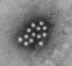 Hepatitis A virus particles are pictured in this electron micrograph. Image: Betty Partin, CDC