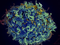This scanning electron micrograph shows HIV particles (colored yellow) infecting a human T cell. Image: National Institute of Allergy and Infectious Diseases, National Institutes of Health