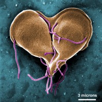 This colorized scanning electron micrograph shows Giardia lamblia reproducing asexually. Image: Stan Erlandsen, CDC’s Public Health Image Library.
