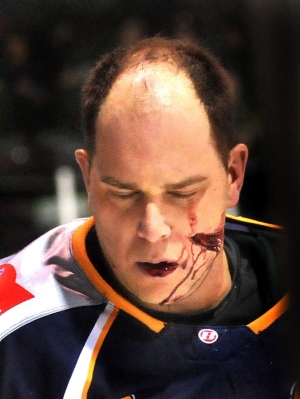 Sports' Most Gruesome Injuries