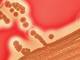 Staphylococcus aureus bacteria colonies on blood agar plate