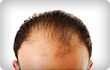 man with thinning hair