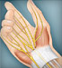 illustration of nerves in hand